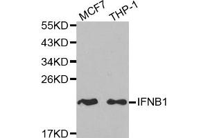 Western blot analysis of extracts of MCF7 and THP-1 cell lines, using IFNB1 antibody.