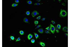 Immunofluorescent analysis of PC-3 cells using ABIN7145339 at dilution of 1:100 and Alexa Fluor 488-congugated AffiniPure Goat Anti-Rabbit IgG(H+L) (ATG14 antibody  (AA 1-492))
