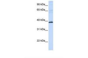 Image no. 1 for anti-Hydroxyacid Oxidase 2 (HAO2) (AA 36-85) antibody (ABIN6737982) (Hydroxyacid Oxidase 2 (HAO2) (AA 36-85) antibody)