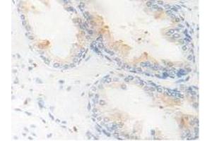 Figure. (Kallikrein 11 antibody  (AA 39-282))