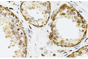 Immunohistochemistry of paraffin-embedded Human prostate using POP4 Polyclonal Antibody at dilution of 1:100 (40x lens). (RPP29 antibody)