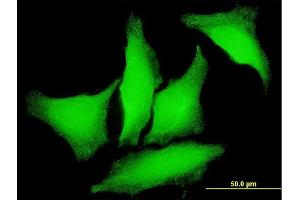 Immunofluorescence of monoclonal antibody to PKD2 on HeLa cell. (PKD2 antibody  (AA 261-360))