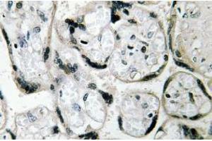 Image no. 1 for anti-Cytochrome B5 Reductase 3 (CYB5R3) antibody (ABIN317921) (CYB5R3 antibody)