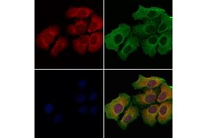 ABIN6259828 and ABIN6278001 staining Hela cells by IF/ICC. (AGR2 antibody  (N-Term))