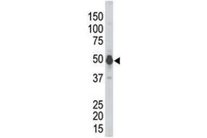 The anti-PHKG2 Pab is used in Western blot to detect PHKG2 in mouse kidney tissue lysate. (PHKG2 antibody  (N-Term))