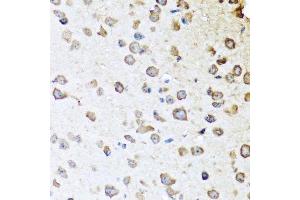 Immunohistochemistry of paraffin-embedded mouse brain using SERPINA10 antibody. (SERPINA10 antibody  (AA 165-444))
