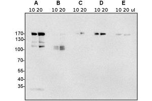 Western Blotting (WB) image for anti-Clathrin Heavy Chain (CLTC) antibody (ABIN7477856) (Clathrin Heavy Chain (CLTC) antibody)