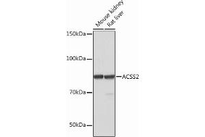 Western blot analysis of extracts of various cell lines, using  Rabbit mAb (ABIN7265427) at 1:1000 dilution. (ACSS2 antibody)