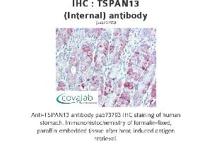 Image no. 2 for anti-Tetraspanin 13 (TSPAN13) (Internal Region) antibody (ABIN1740425) (TSPAN13 antibody  (Internal Region))