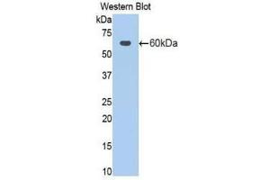 Western Blotting (WB) image for anti-Activated Leukocyte Cell Adhesion Molecule (ALCAM) (AA 28-527) antibody (ABIN1077751) (CD166 antibody  (AA 28-527))