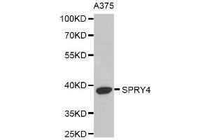 Western Blotting (WB) image for anti-Sprouty RTK Signaling Antagonist 4 (SPRY4) antibody (ABIN1980279) (SPRY4 antibody)