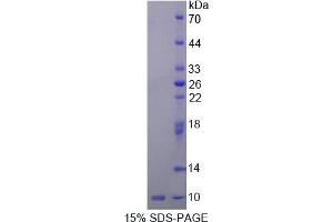 SDS-PAGE analysis of Rat Insulin Like Growth Factor 2 (IGF2) Protein. (IGF2 Protein)