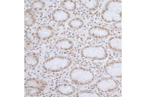 Immunohistochemistry (IHC) image for anti-ElaC Homolog 2 (ELAC2) (AA 150-200) antibody (ABIN7455053) (ELAC2 antibody  (AA 150-200))