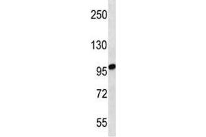 STIM2 antibody western blot analysis in uterus tumor lysate. (Stim2 antibody  (AA 98-127))