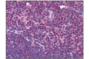 Human Thymus: Formalin-Fixed, Paraffin-Embedded (FFPE) (HVCN1 antibody  (C-Term))