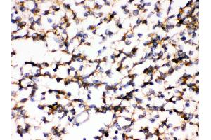 Anti- KCNIP2 Picoband antibody,IHC(P) IHC(P): Human Glioma Tissue (KCNIP2 antibody  (N-Term))