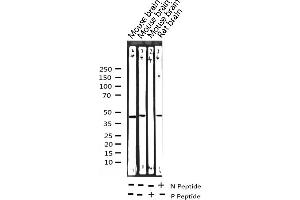 Western blot analysis of Phospho-C/EBP alpha (Ser21) expression in various lysates (CEBPA antibody  (pSer21))