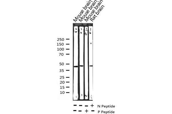 CEBPA antibody  (pSer21)