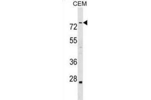 Western Blotting (WB) image for anti-Actin Binding LIM Protein Family, Member 3 (ABLIM3) antibody (ABIN2999456)