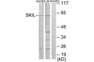 Western Blotting (WB) image for anti-SKI-Like Oncogene (SKIL) (C-Term) antibody (ABIN1849158) (SKIL antibody  (C-Term))