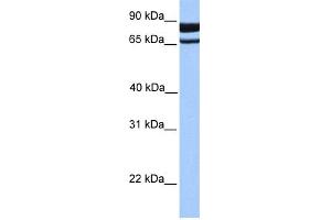 WB Suggested Anti-PDE1C Antibody Titration: 0.