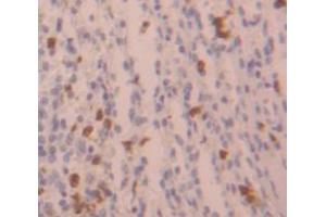 Figure. (HIST2H3A antibody  (AA 1-136))