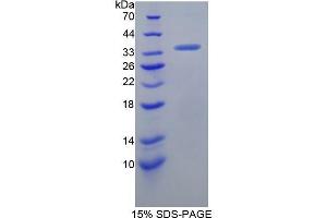 SDS-PAGE (SDS) image for Glypican 4 (GPC4) (AA 261-527) protein (His tag) (ABIN1525434) (GPC4 Protein (AA 261-527) (His tag))