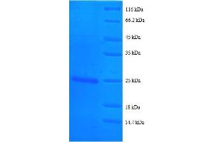 SDS-PAGE (SDS) image for Basigin (Ok Blood Group) (BSG) (AA 138-321), (partial) protein (His tag) (ABIN1046597)