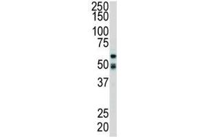 Western blot analysis of RIPK2 antibody and mouse cerebellum tissue lysate. (RIPK2 antibody  (AA 458-488))