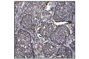 IHC analysis of CLPP using anti-CLPP antibody (ABIN5693176). (CLPP antibody  (AA 184-247))