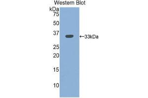 Western Blotting (WB) image for anti-Integrin beta 3 (ITGB3) (AA 134-376) antibody (ABIN1859506) (Integrin beta 3 antibody  (AA 134-376))