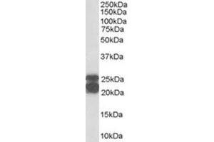 Image no. 2 for anti-Caveolin 1, Caveolae Protein, 22kDa (CAV1) (Internal Region) antibody (ABIN374578) (Caveolin-1 antibody  (Internal Region))