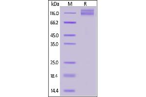 Human ITGAV&ITGB1 Heterodimer Protein, Tag Free&Tag Free on  under reducing (R) condition. (ITGAV/ITGB1 Protein (AA 31-992))