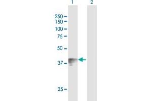 Western Blotting (WB) image for anti-Wingless-Type MMTV Integration Site Family, Member 7B (WNT7B) (AA 1-349) antibody (ABIN521390)
