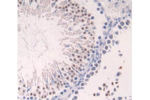 Used in DAB staining on fromalin fixed paraffin- embedded Kidney tissue (Aurora Kinase C antibody  (AA 20-277))
