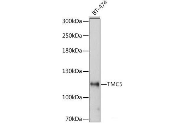 Tmc5 antibody