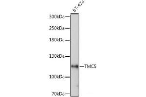 Western blot analysis of extracts of BT-474 cells using TMC5 Polyclonal Antibody at dilution of 1:1000. (Tmc5 antibody)