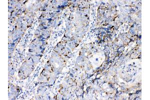 IHC analysis of Bax using anti-Bax antibody . (BAX antibody  (N-Term))