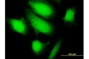 Immunofluorescence of purified MaxPab antibody to KCTD17 on HeLa cell. (KCTD17 antibody  (AA 1-290))