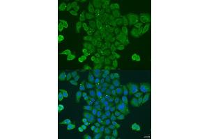 Immunofluorescence analysis of U2OS cells using DPM1 antibody (ABIN2736653) at dilution of 1:100. (DPM1 antibody)