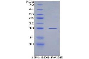 SDS-PAGE (SDS) image for Keratin 19 (KRT19) (AA 245-391) protein (His tag) (ABIN1170819) (Cytokeratin 19 Protein (AA 245-391) (His tag))