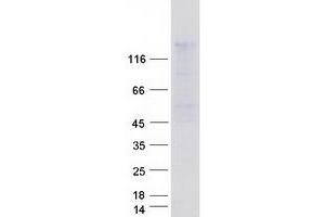 Validation with Western Blot (TIMELESS Protein (Myc-DYKDDDDK Tag))