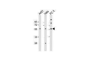 Western Blot at 1:2000 dilution Lane 1: A431 whole cell lysate Lane 2: Hela whole cell lysate Lane 3: PC-3 whole cell lysate Lysates/proteins at 20 ug per lane. (CCT8L2 antibody  (AA 511-542))