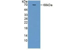 Detection of Recombinant ADIPOR2, Human using Polyclonal Antibody to Adiponectin Receptor 2 (ADIPOR2) (Adiponectin Receptor 2 antibody  (AA 180-367))