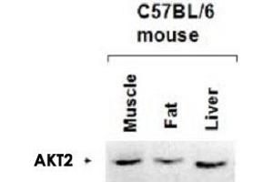 Immunoblotting of AKT2 polyclonal antibody  to AKT2 was used at a 1 : 1,000 dilution to detect AKT2 by Western blot in lysates from mouse tissues. (AKT2 antibody  (AA 455-468))
