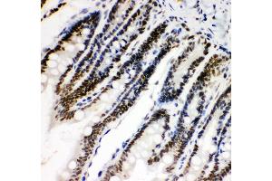 Immunohistochemistry (IHC) image for anti-Hypoxia Inducible Factor 1, alpha Subunit (Basic Helix-Loop-Helix Transcription Factor) (HIF1A) (AA 703-732), (C-Term) antibody (ABIN3043841)