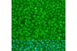 Immunofluorescence analysis of U2OS cells using MMP8 Polyclonal Antibody at dilution of 1:100. (MMP8 antibody)