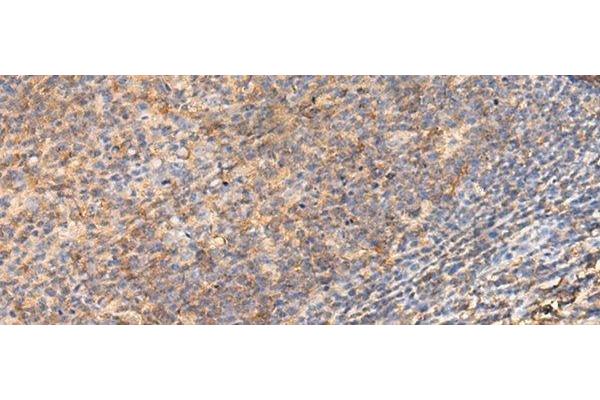GPR123 antibody