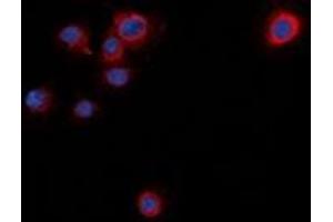Immunofluorescent analysis of Syntaxin 1A (pS14) staining in NIH3T3 cells. (STX1A antibody  (N-Term, pSer14))