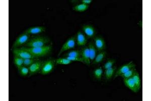 Immunofluorescent analysis of HepG2 cells using ABIN7154260 at dilution of 1:100 and Alexa Fluor 488-congugated AffiniPure Goat Anti-Rabbit IgG(H+L) (GRHPR antibody  (AA 1-328))